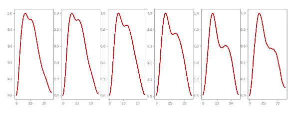PPG waveforms illustrating changes in vascular state